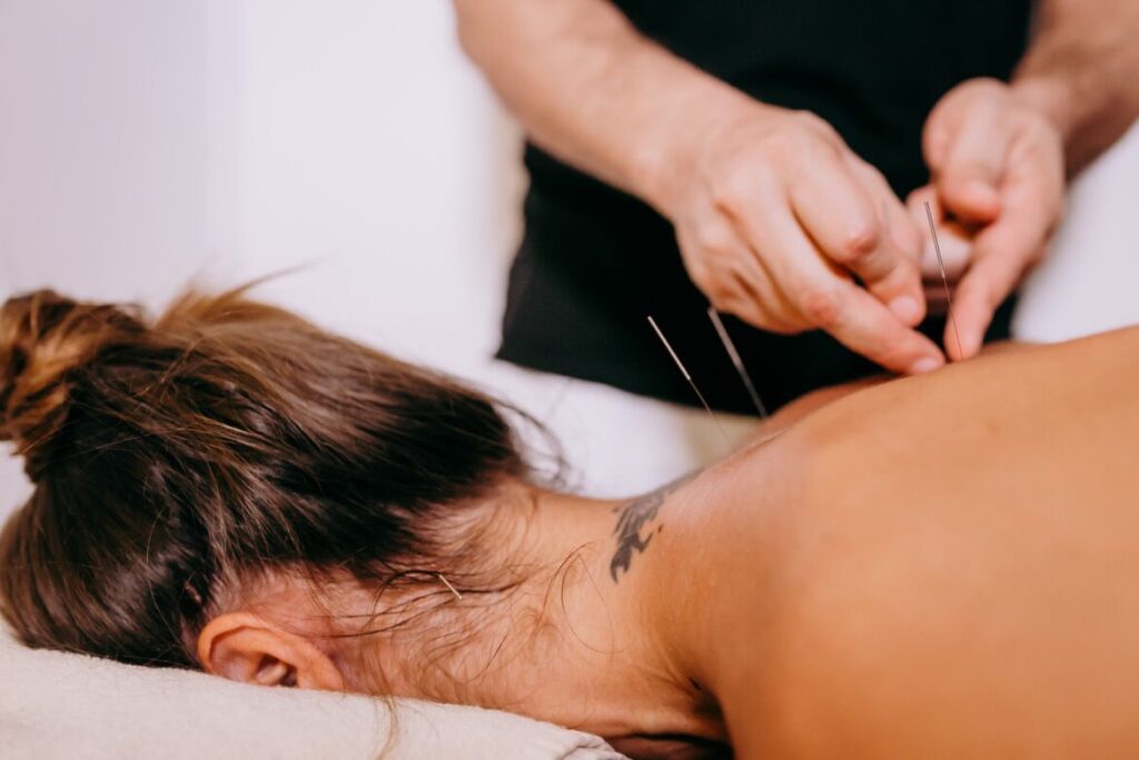 Acupuncture Therapy: The Essential Guide
