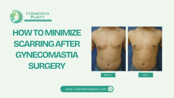 How to minimise scarring after gynecomastia surgery