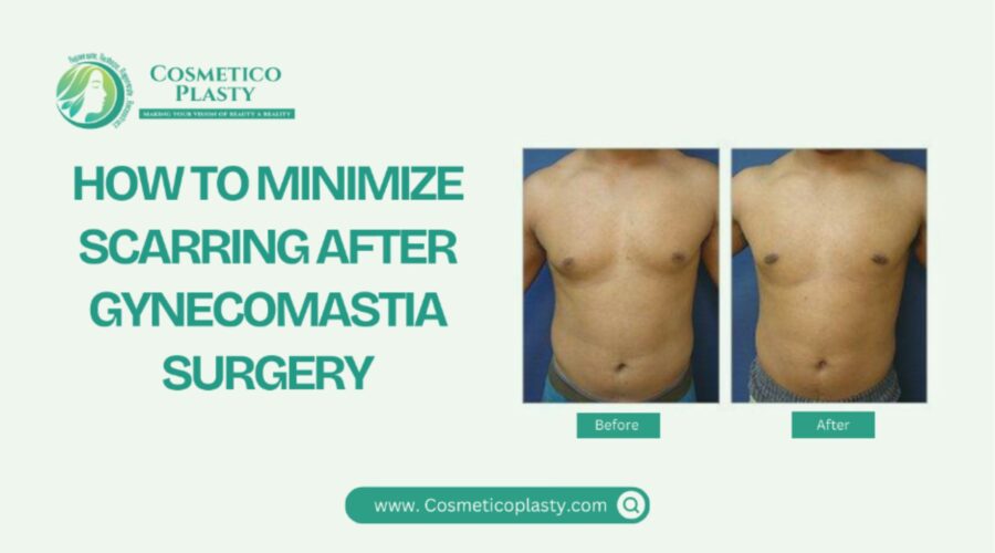 How To Minimize Scarring After Gynecomastia Surgery?