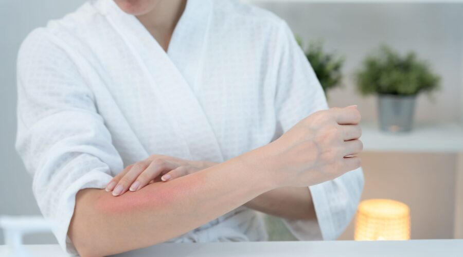 A Holistic Approach to Healing From Topical Steroid Withdrawal