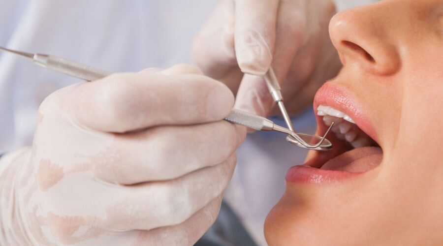 Lifespan of a Dental Filling: When and Why Should You Opt for a Replacement?